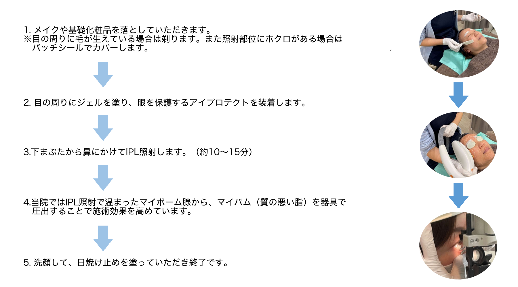 ドライアイの治療の流れ